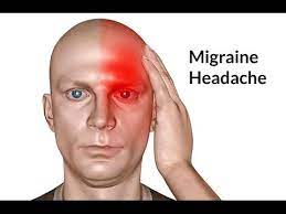 migraine nên giảm caffeine